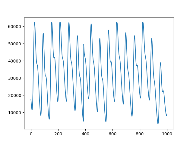 plot SQI Pandas on Multiple Patients