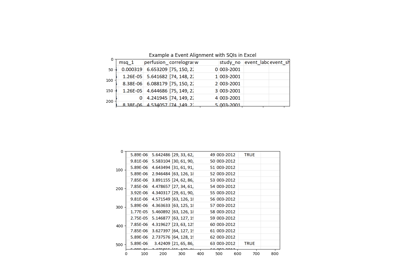 Matching SQI Dataframe Window to Clinical Time of "Event" for Multiple Records